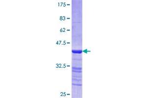 MYH3 Protein (AA 2-100) (GST tag)