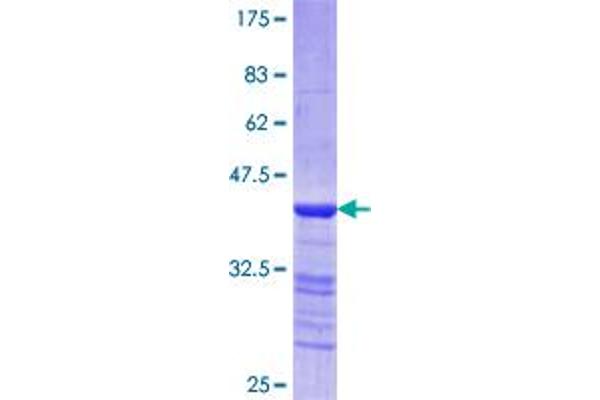 MYH3 Protein (AA 2-100) (GST tag)