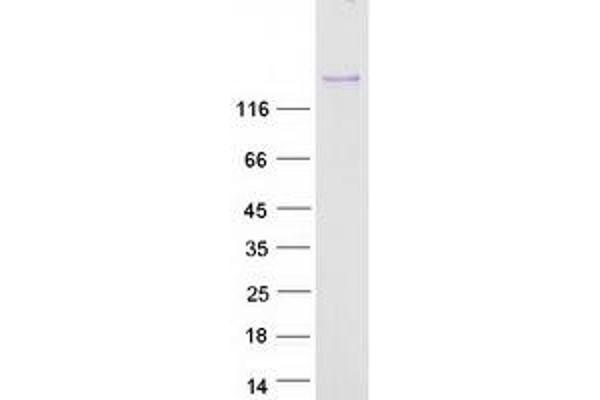 RIMBP2 Protein (Myc-DYKDDDDK Tag)