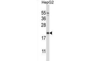 Western Blotting (WB) image for anti-NADH Dehydrogenase (Ubiquinone) 1 alpha Subcomplex, Assembly Factor 2 (NDUFAF2) antibody (ABIN2997290) (NDUFAF2 antibody)