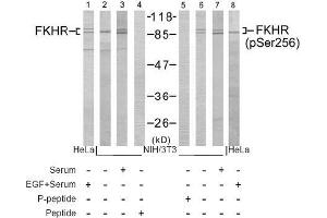 Image no. 1 for anti-Forkhead Box O1 (FOXO1) (pSer256) antibody (ABIN196813) (FOXO1 antibody  (pSer256))
