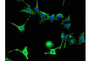 Immunofluorescent analysis of MCF-7 cells using ABIN7152652 at dilution of 1:100 and Alexa Fluor 488-congugated AffiniPure Goat Anti-Rabbit IgG(H+L) (FAAH antibody  (AA 205-342))