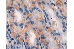 IHC-P analysis of stomach tissue, with DAB staining. (TUBB1 antibody  (AA 166-451))