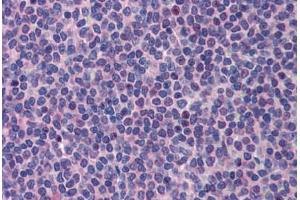 Human Spleen (formalin-fixed, paraffin-embedded) stained with PML antibody ABIN462187 followed by biotinylated goat anti-rabbit IgG secondary antibody ABIN481713, alkaline phosphatase-streptavidin and chromogen. (PML antibody  (AA 588-637))