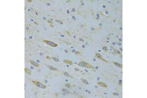 Immunohistochemistry of paraffin-embedded rat brain using SARS Antibody. (Seryl-tRNA Synthetase (SARS) (AA 1-300) antibody)