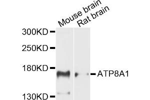 Western blot analysis of extracts of various cell lines, using ATP8A1 antibody (ABIN5971746) at 1/1000 dilution. (ATP8A1 antibody)