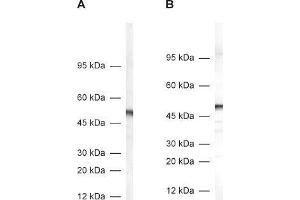 dilution: 1 : 1000, A: rat adrenal gland homogenate, B: mouse brain homogenate (DDC antibody)