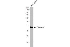 WB Image Vitronectin antibody detects Vitronectin protein by western blot analysis. (Vitronectin antibody)