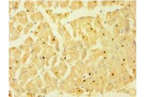 Immunohistochemistry of paraffin-embedded human heart tissue using ABIN7146925 at dilution of 1:100 (Caspase 1 antibody  (AA 120-269))