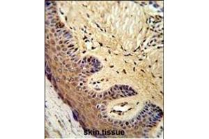 Formalin-fixed and paraffin-embedded human skin reacted with MC Antibody (Center), which was peroxidase-conjugated to the secondary antibody, followed by DAB staining. (MCAM antibody  (AA 161-189))