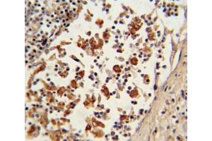 IHC analysis of FFPE human lymph tissue with BCL6 antibody (BCL6 antibody  (AA 519-547))