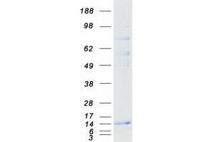 Western Blotting (WB) image for Ring Finger Protein 7 (RNF7) (Transcript Variant 1) protein (Myc-DYKDDDDK Tag) (ABIN2731048)