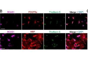 Extracellularly applied recombinant human α-syn PFFs induced cytoplasmic α-syn-immunoreactive inclusions in primary BCAS1(+) cell cultures. (BCAS1 antibody  (AA 542-584))