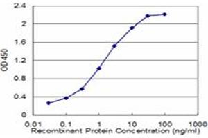 Detection limit for recombinant GST tagged LDLR is approximately 0. (LDLR antibody  (AA 105-205))
