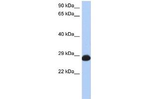 WB Suggested Anti-RAB39B Antibody Titration: 0. (RAB39B antibody  (N-Term))