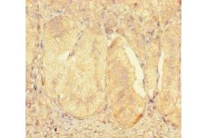 Immunohistochemistry of paraffin-embedded human adrenal gland tissue using ABIN7176128 at dilution of 1:100 (ZNF175 antibody  (AA 1-711))