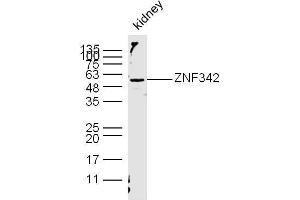 Mouse kidney lysates probed with ZNF342/ZNF296 Polyclonal Antibody, unconjugated  at 1:300 overnight at 4°C followed by a conjugated secondary antibody at 1:10000 for 60 minutes at 37°C.