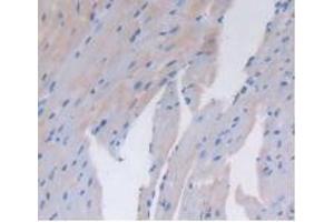 Detection of CD26 in Mouse Heart Tissue using Polyclonal Antibody to Cluster Of Differentiation 26 (CD26) (DPP4 antibody  (AA 29-178))
