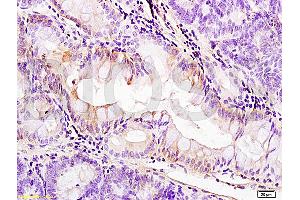 Formalin-fixed and paraffin embedded: rat colitis tissue labeled with Anti-PDGFRA Polyclonal Antibody, Unconjugated (ABIN726620) at 1:200, followed by conjugation to the secondary antibody and DAB staining (PDGFRA antibody  (AA 1021-1089))