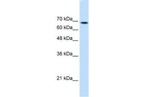 Western Blotting (WB) image for anti-Transglutaminase 2 (C Polypeptide, Protein-Glutamine-gamma-Glutamyltransferase) (TGM2) antibody (ABIN2463067) (Transglutaminase 2 antibody)