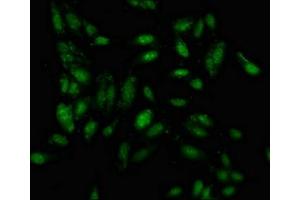 Immunofluorescence staining of Hela cells with ABIN7156618 at 1:100, counter-stained with DAPI. (IRF2BP1 antibody  (AA 340-499))