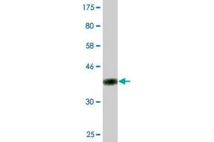 Western Blot detection against Immunogen (36. (RANKL antibody  (AA 222-316))