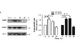 IFN-γ increased rates of autophagy in primary BMECs in vitro. (RTN4RL2 antibody  (AA 241-337))