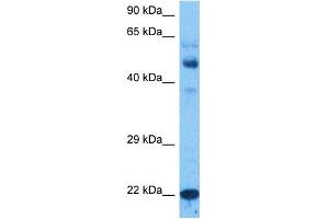 Host:  Rabbit  Target Name:  NTM1A  Sample Tissue:  Large Intestine Tumor lysates  Antibody Dilution:  1ug/ml (METTL11A antibody  (N-Term))
