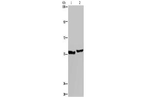 Western Blotting (WB) image for anti-Solute Carrier Family 1 (High Affinity Aspartate/glutamate Transporter), Member 6 (SLC1A6) antibody (ABIN2431275) (SLC1A6 antibody)