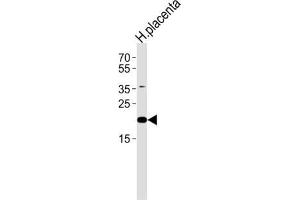 Western Blotting (WB) image for anti-Chromosome 2 Open Reading Frame 74 (C2ORF74) antibody (ABIN3004714) (C2ORF74 antibody)