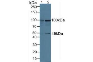 Figure. (TNIP2 antibody  (AA 170-413))