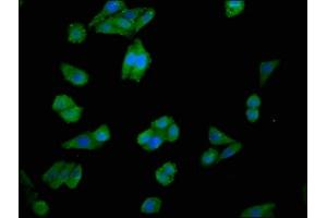Immunofluorescence staining of HepG2 cells with ABIN7147616 at 1:100, counter-stained with DAPI. (Choline Kinase alpha antibody  (AA 79-173))