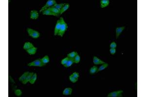 Immunofluorescence staining of HepG2 cells with ABIN7147616 at 1:100, counter-stained with DAPI. (Choline Kinase alpha antibody  (AA 79-173))