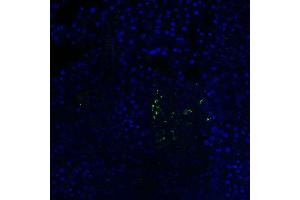 Mouse Pancreas (C57BL/6 strain) fixed in 4% PFA for 2 hours at RT, then transferred to 30% sucrose overnight at 4 °C before embedding in OCT mounting medium. (Somatostatin antibody  (AA 75-107))