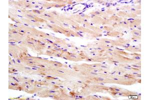 Formalin-fixed and paraffin embedded rat heart labeled with Anti-WDR26 Polyclonal Antibody, Unconjugated (ABIN729988) at 1:200 followed by conjugation to the secondary antibody and DAB staining (WDR26 antibody  (AA 101-200))