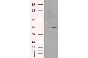 Western Blotting (WB) image for anti-LEM Domain Containing 3 (LEMD3) antibody (ABIN1499117)