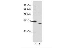 Image no. 1 for anti-Proteasome Subunit alpha Type 1 (PSMA1) (N-Term) antibody (ABIN203038)