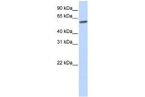 WB Suggested Anti-SENP3 Antibody Titration: 0. (SENP3 antibody  (N-Term))