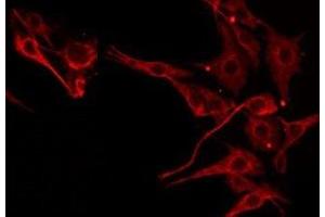 Immunofluorescence (fixed cells) (IF/ICC) image for anti-serpin Peptidase Inhibitor, Clade B (Ovalbumin), Member 4 (SERPINB4) (C-Term) antibody (ABIN6258679)