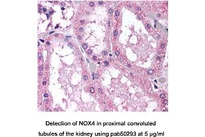 Image no. 2 for anti-NADPH Oxidase 4 (NOX4) (AA 100-200) antibody (ABIN363602) (NADPH Oxidase 4 antibody  (AA 100-200))