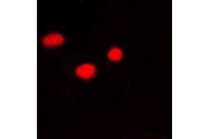 Immunofluorescent analysis of PSMB10 staining in Hela cells. (PSMB10 antibody)