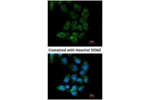 ICC/IF Image Immunofluorescence analysis of paraformaldehyde-fixed A431, using USP15, antibody at 1:200 dilution. (USP15 antibody  (C-Term))