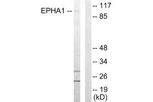 Western blot analysis of extracts from COLO205 cells, using EPHA1 antibody. (EPHA1 antibody  (Internal Region))