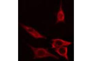 ABIN6267676 staining COLO205 cells by IF/ICC. (B-Cell Linker antibody  (pTyr96))
