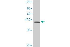 Western Blot detection against Immunogen (38. (RALGDS antibody  (AA 793-902))
