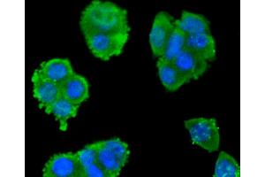 SW480 cells were fixed in paraformaldehyde, permeabilized with 0. (SMAD3 antibody)