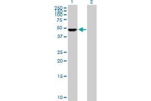 Western Blot analysis of UCKL1 expression in transfected 293T cell line by UCKL1 MaxPab polyclonal antibody. (UCKL1 antibody  (AA 1-419))