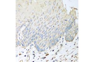 Immunohistochemistry of paraffin-embedded human esophagus using SGCB antibody at dilution of 1:100 (40x lens).
