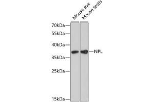 Western blot analysis of extracts of various cell lines, using NPL antibody (ABIN6132931, ABIN6144778, ABIN6144779 and ABIN6224929) at 1:3000 dilution. (NPL antibody  (AA 1-250))