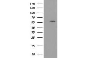 HEK293T cells were transfected with the pCMV6-ENTRY control (Left lane) or pCMV6-ENTRY DTNA (Right lane) cDNA for 48 hrs and lysed. (DTNA antibody)